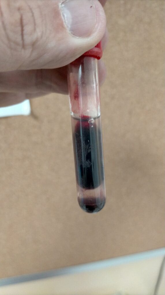 Próbka przygotowana do analizy parametrów biochemicznych krwi